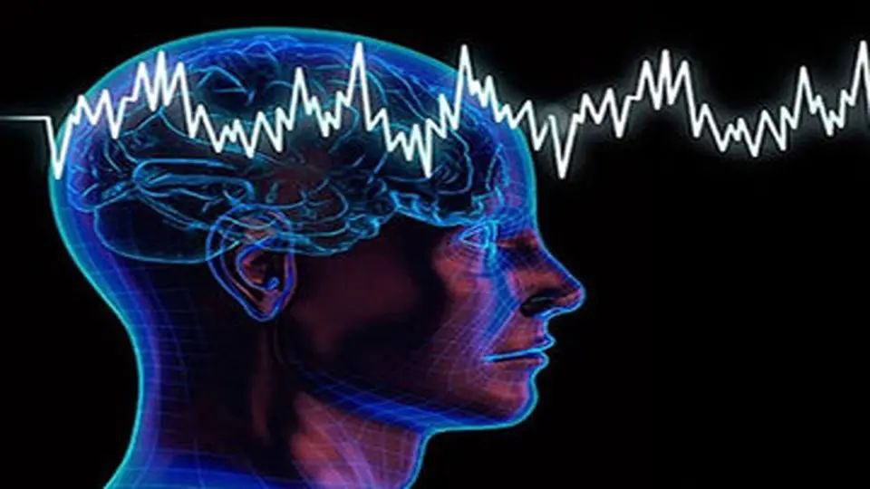 متخصص بیماری‎های مغز و اعصاب: ایرانی‌ها ۱۰ سال زیر سن متوسط جهانی سکته می‌کنند